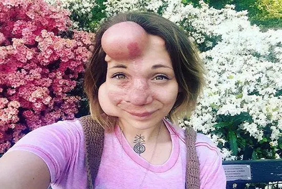 چهره عجیب این دختر را بعد عمل زیبایی ببینید+ عکس