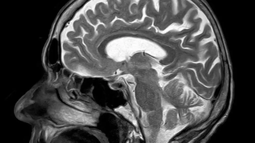 دانشمندان در آزمایشگاه «مغز انسان» تولید می‌کنند؛ فوق‌العاده یا غیر اخلاقی؟!