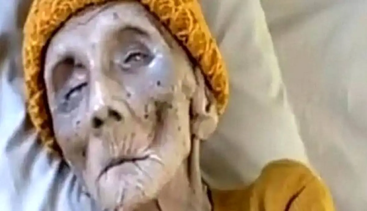 چهره باورنکردنی پیرترین پیرزن جهان در سن 399 سالگی!/ عکس
