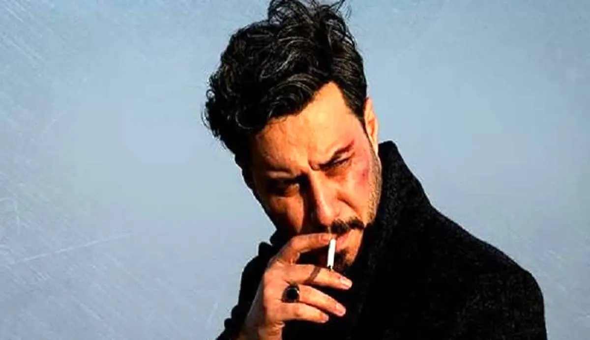 زخم کاری بر چهره “جواد عزتی”/ عکس