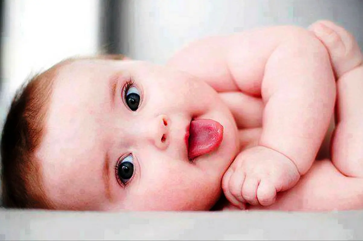 عکس/ تولد یک نوزاد عجیب با سری شبیه قلب