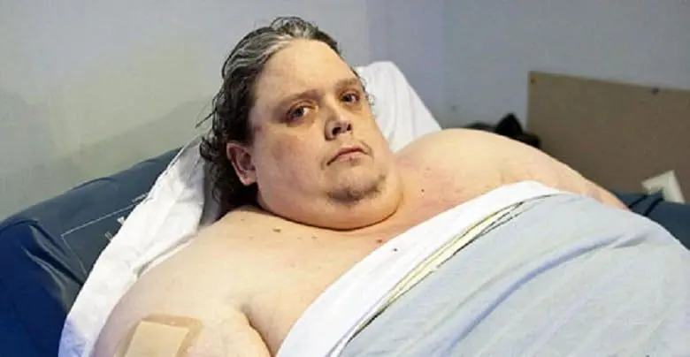 تصاویر/ چاق‌ترین انسان روی زمین با ۳۷۰ کیلو وزن! 

